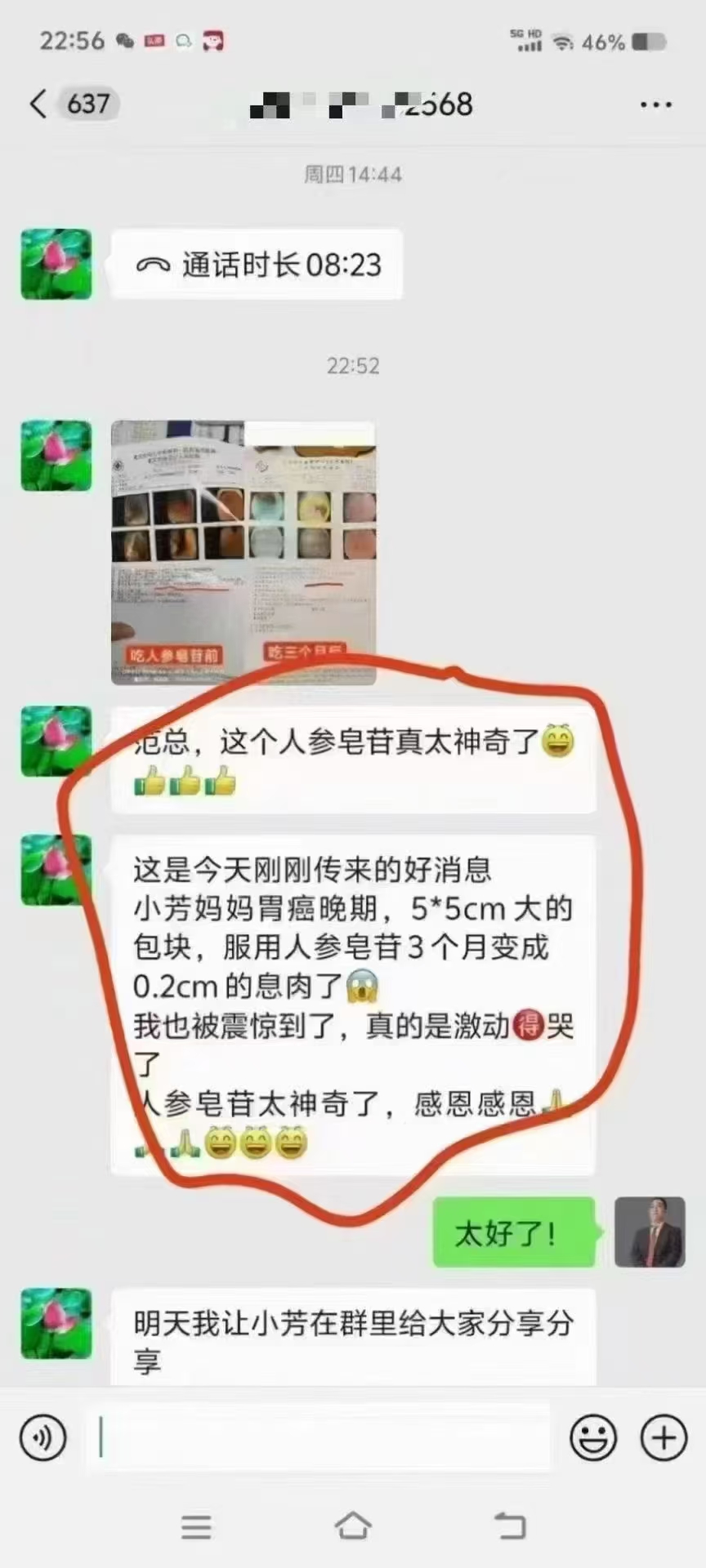 结节癌症小芳妈妈