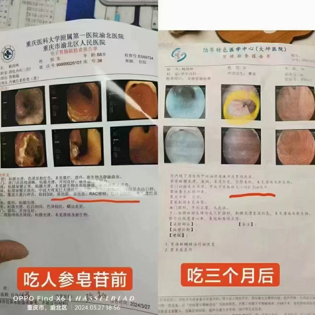 结节癌症小芳妈妈1